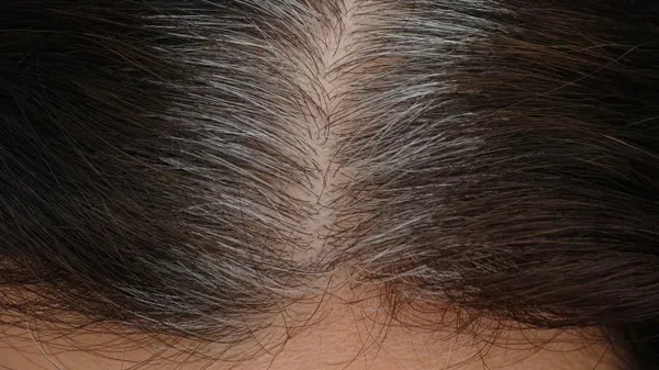 My Hair Is Going Gray During the Pandemic. Here's Why I May Never Color It Again